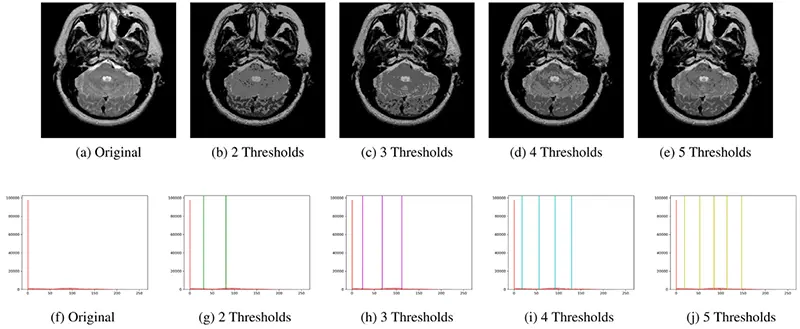 آستانه‌گذاری چندسطحی برای بخش‌بندی MRI مغز
